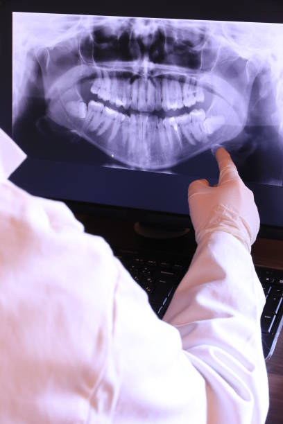 Best Emergency Denture Repair in Fulton, NY